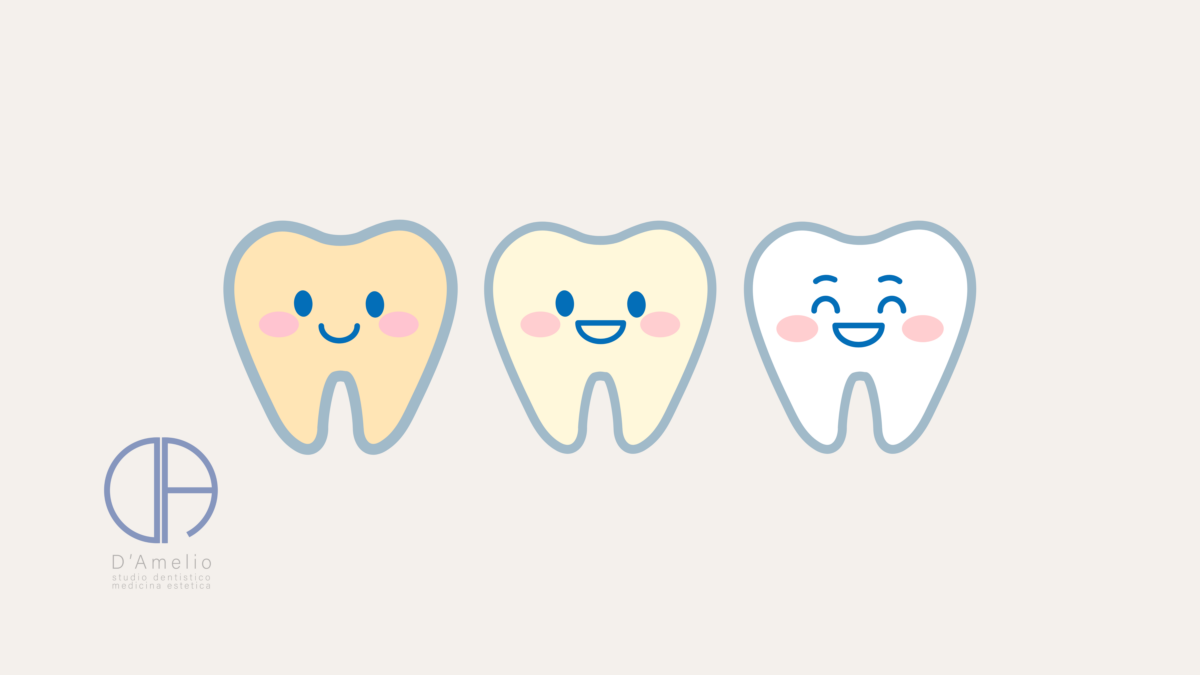 Sbiancamento Domiciliare
