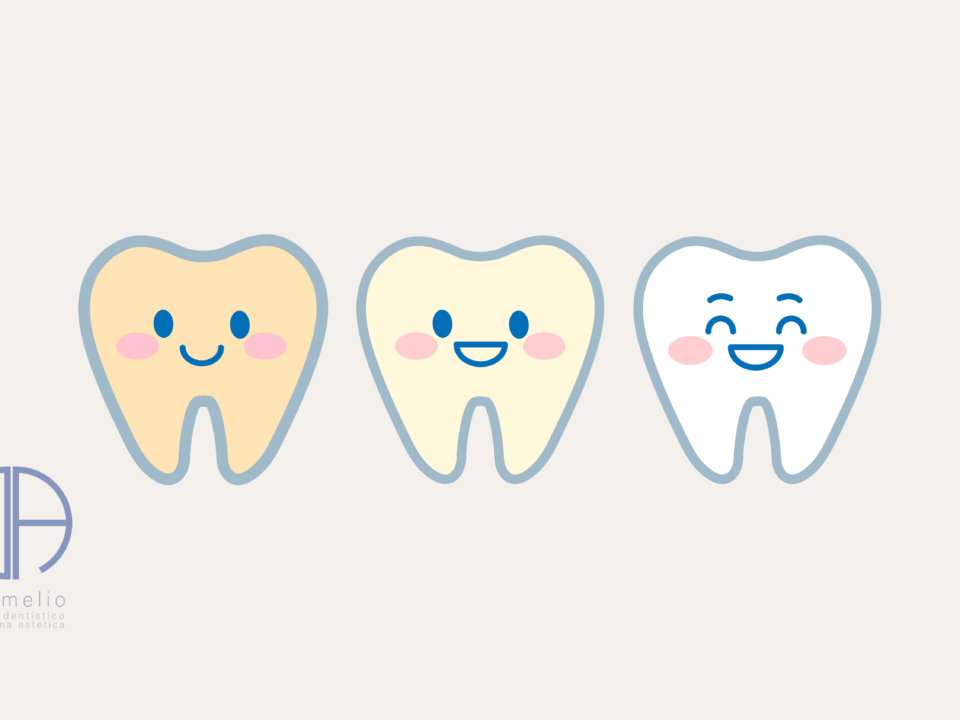 Sbiancamento Domiciliare