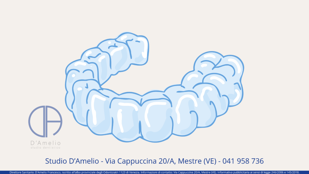 Allineatori Trasparenti