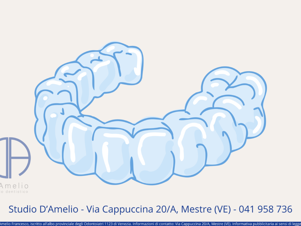 Allineatori Trasparenti